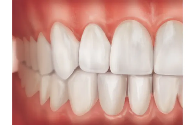 Patient Education Topic - Gingival Health
