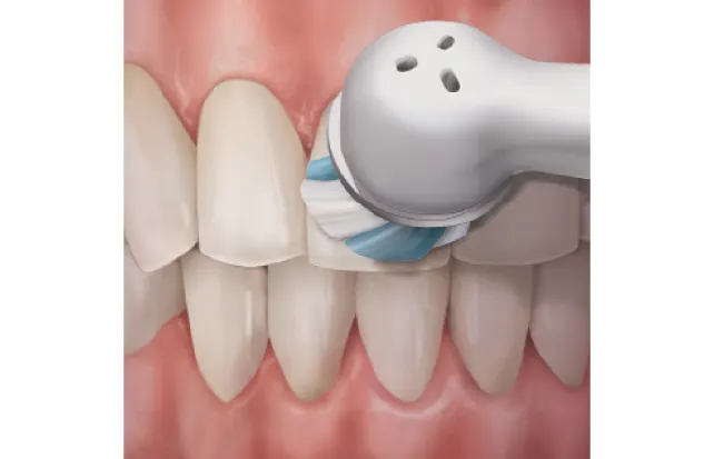 Patient Education Topic - Oral Hygiene