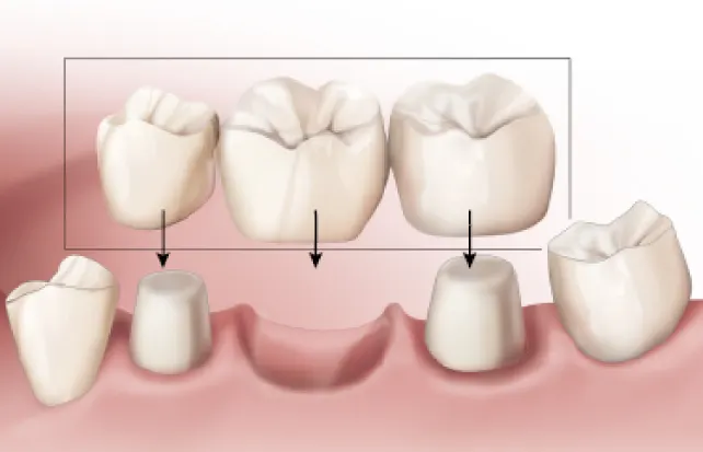 Patient Education - Restorative & Specialty Dentistry