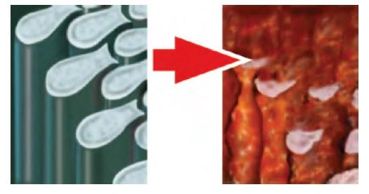 Dental erosion process