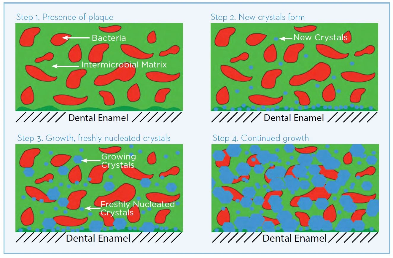 Formation of dental calculus
