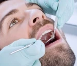 Gum Disease