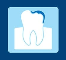 Bioavailable gluconate chelated stannous fluoride toothpaste meta-analyses: Effects on dentine hypersensitivity and enamel erosion