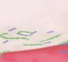 Stabilized Stannous Fluoride in Action