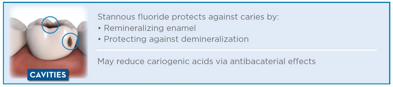 Stannous fluoride protects against caries