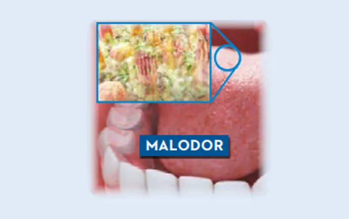PrimaryImage
Stannous_Research_2_Dentifrice_Controls